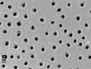  牙本質小管顯微圖