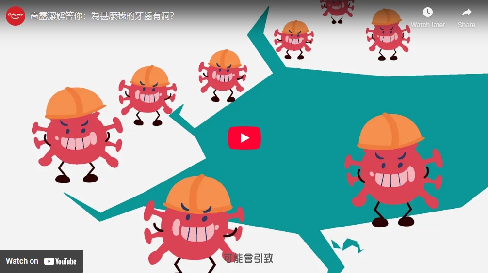 齲病問題：為什麼我的牙齒有洞？