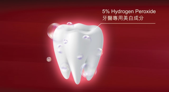 5% Hydrogen Peroxide牙醫專用美白成分，深層導入牙齒