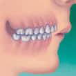 牙齒深覆合和齒顎矯正 - 高露潔香港