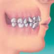 牙齒擁擠和齒顎矯正 - 高露潔香港