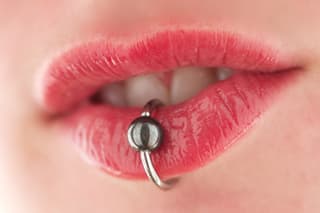 Tongue piercing issues